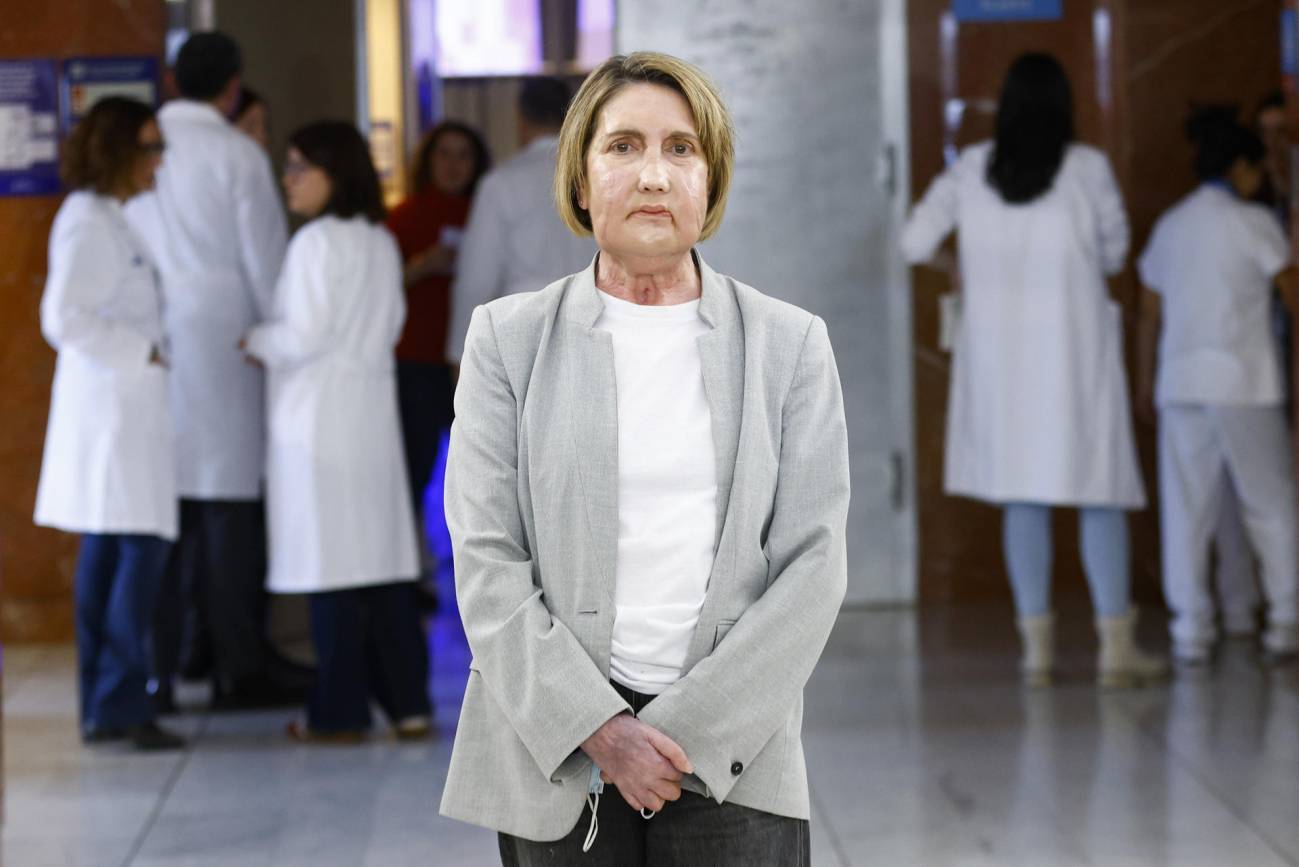 El hospital Vall d'Hebron realiza el primer trasplante de cara del mundo con una donante de eutanasia