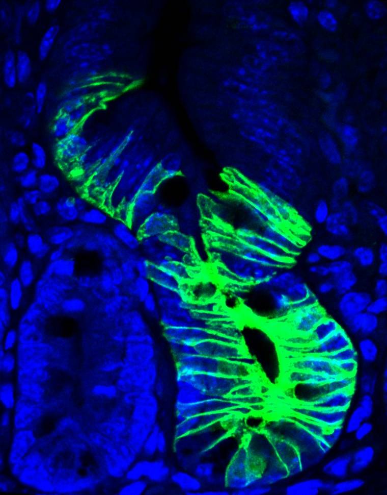 Celulas madre quiescentes en el intestino