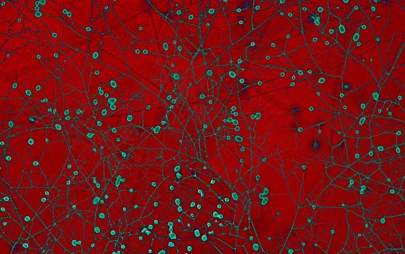 Hongos micorrízicos vistos al microscopio