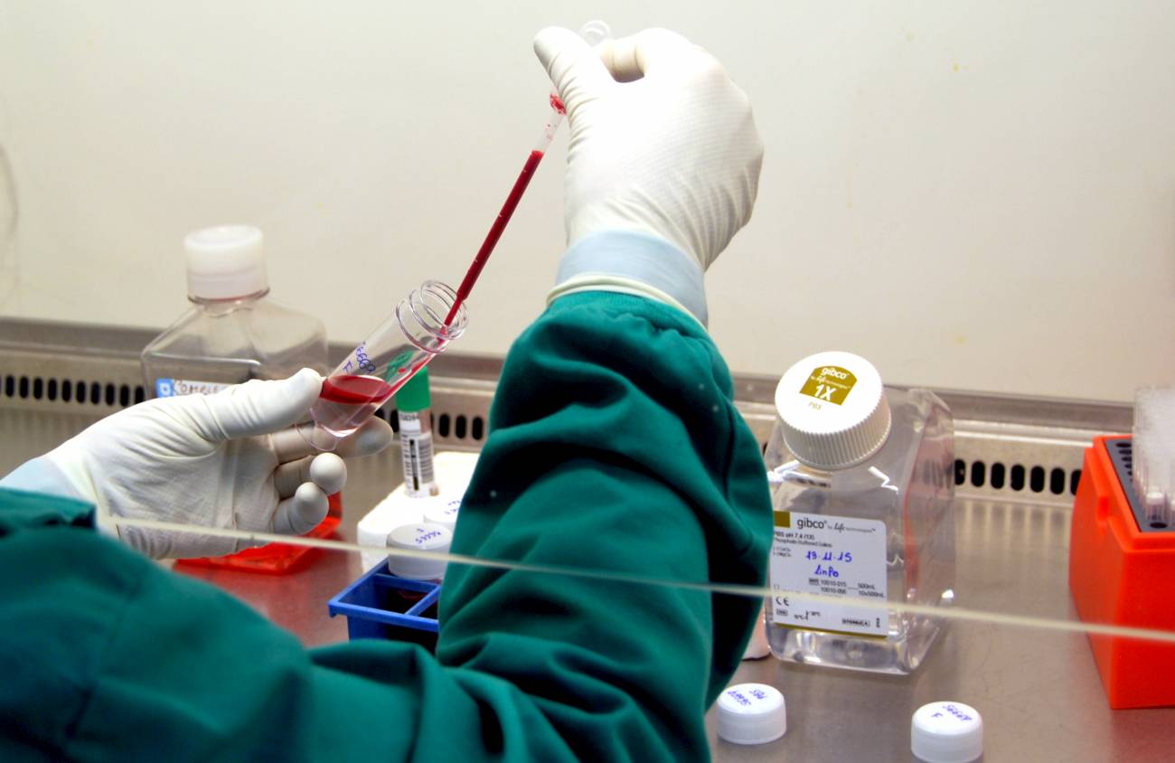 El riesgo de leishmaniasis se multiplica por cien en pacientes trasplantados 