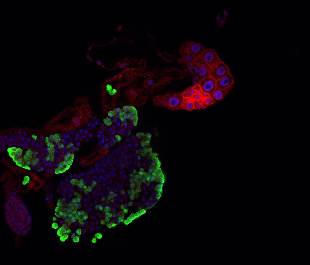 macrofagos, Drosophila, desarrollo, azúcar