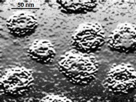 El virus del papiloma humano es más persistente en mujeres infectadas por el VIH 