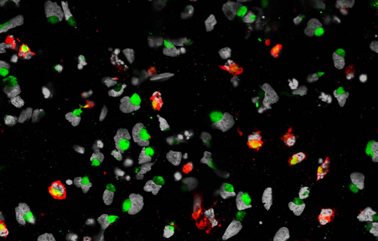 El Zika infecta las células madre neurales que producen la corteza cerebral