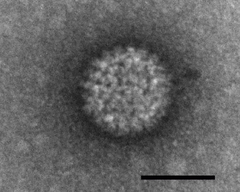 Partícula del virus de la lengua azul. /Wikipedia.