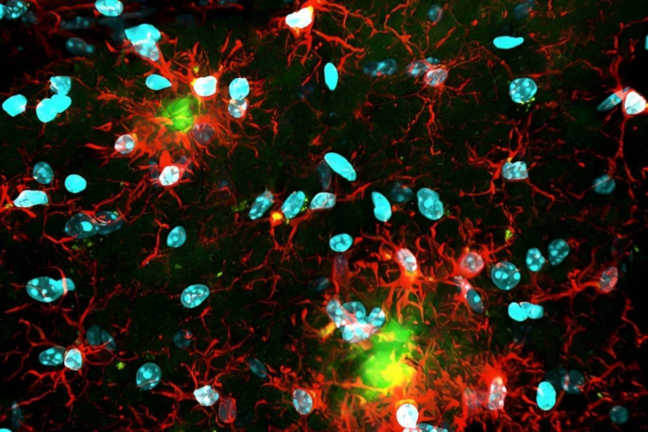 imagen del cerebro de un ratón con alzhéimer