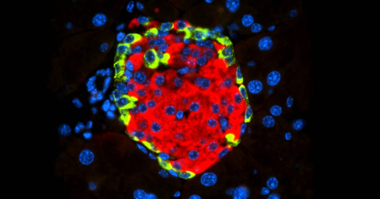 Este es el mecanismo molecular por el que un virus puede causar diabetes 