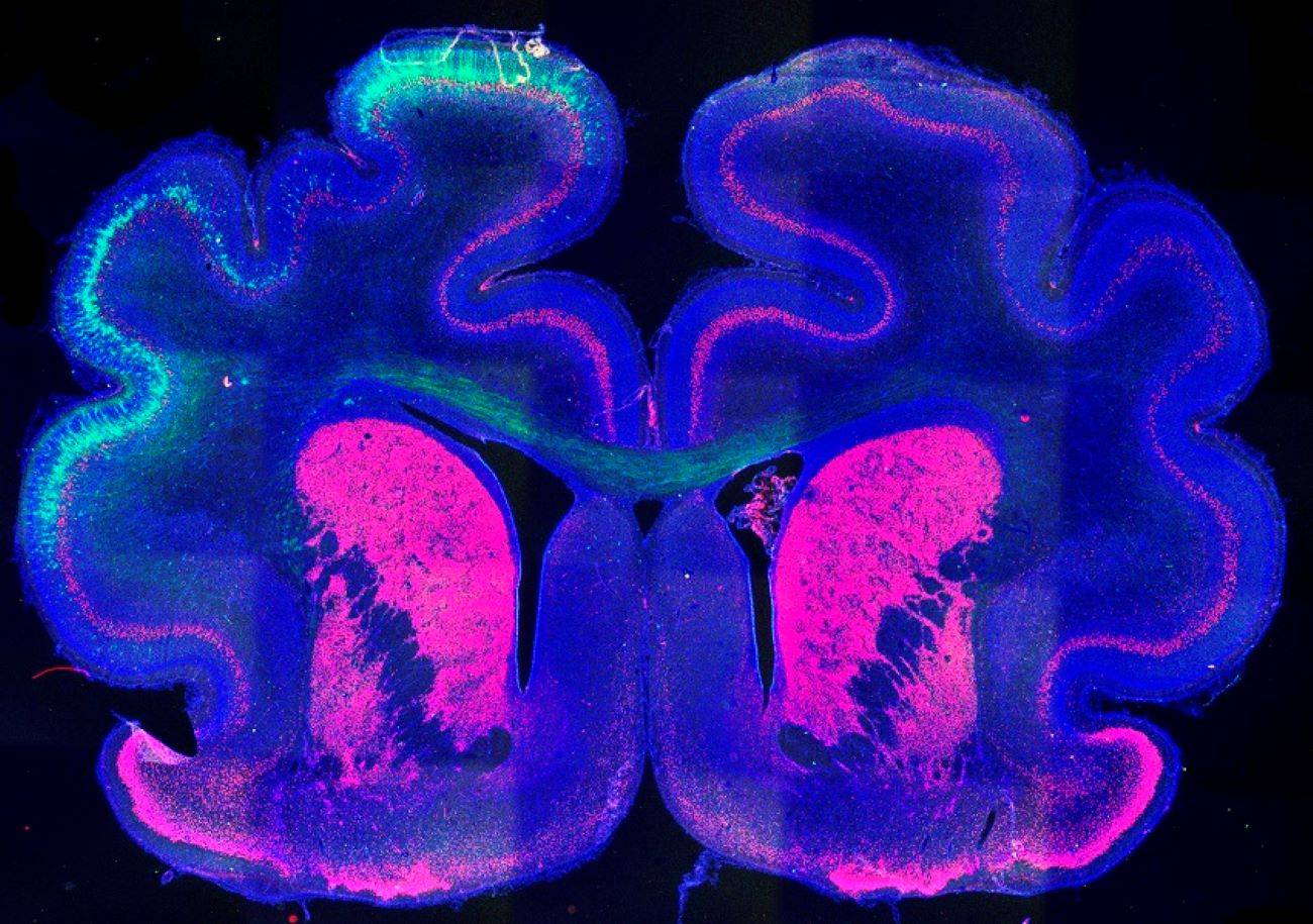 Este mecanismo determina la formación de pliegues en la corteza cerebral
