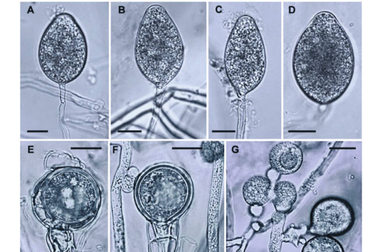 Aspecto morfológico del patógeno exótico Phytophthora cinnamomi al microscopio.