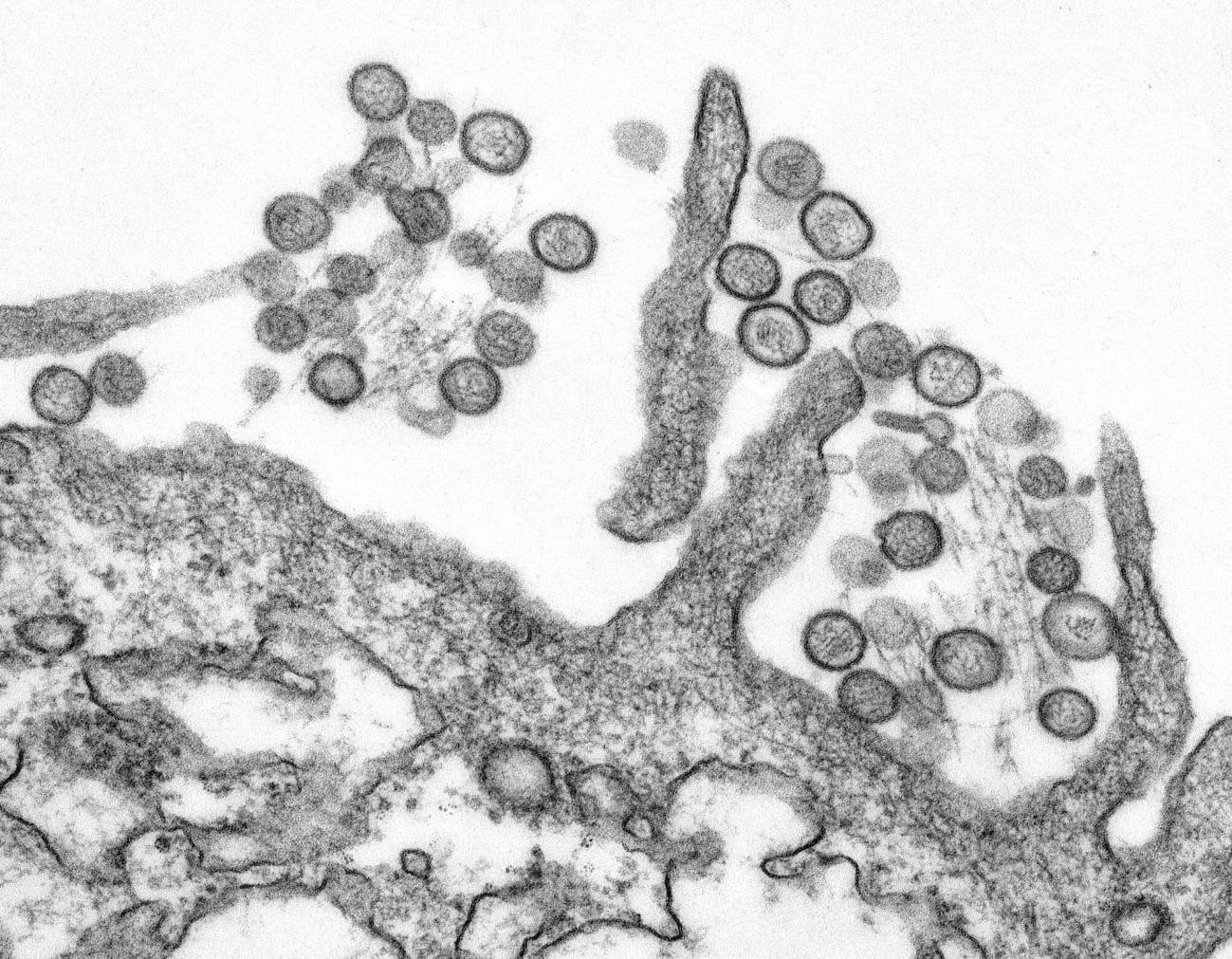 Imagen por microscopía de un hantavirus