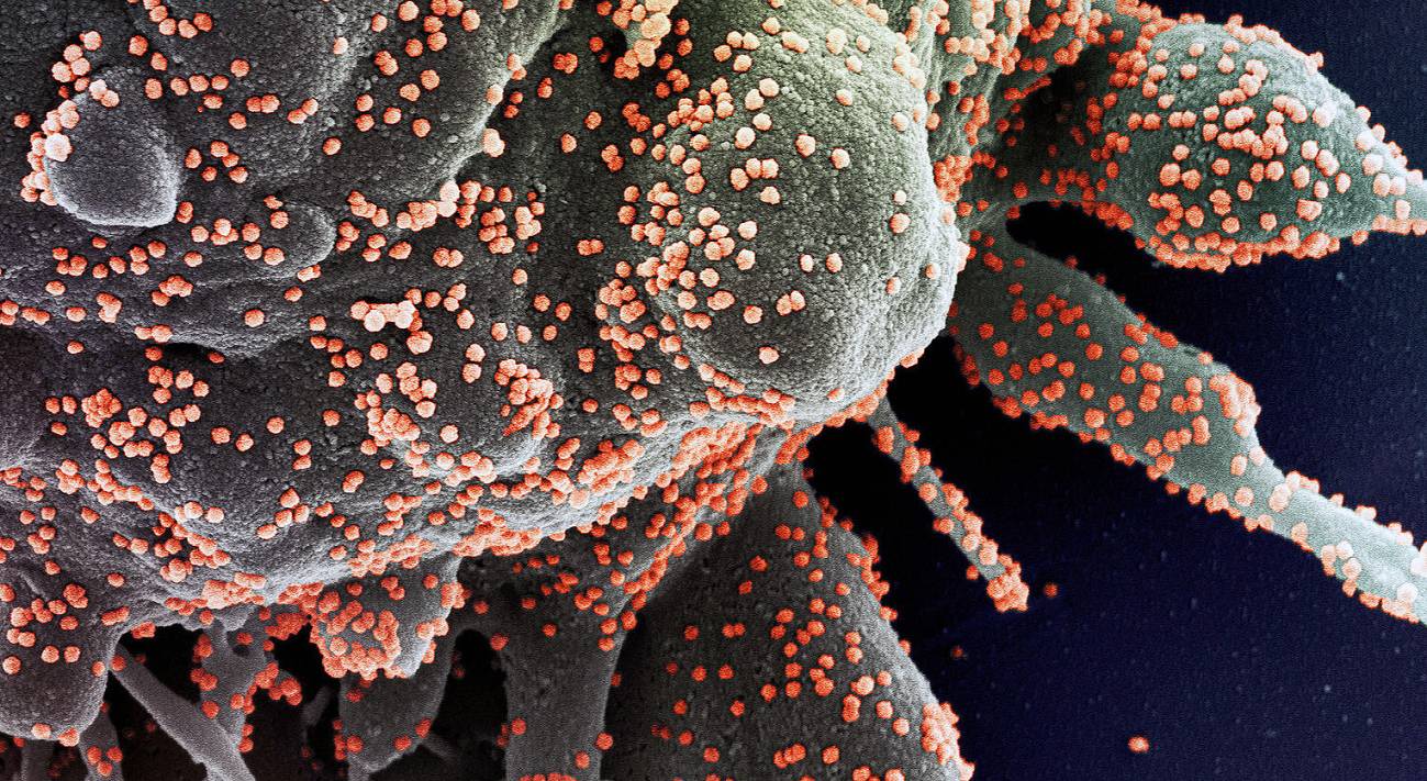 Fármacos candidatos para tratar las complicaciones pulmonares del coronavirus