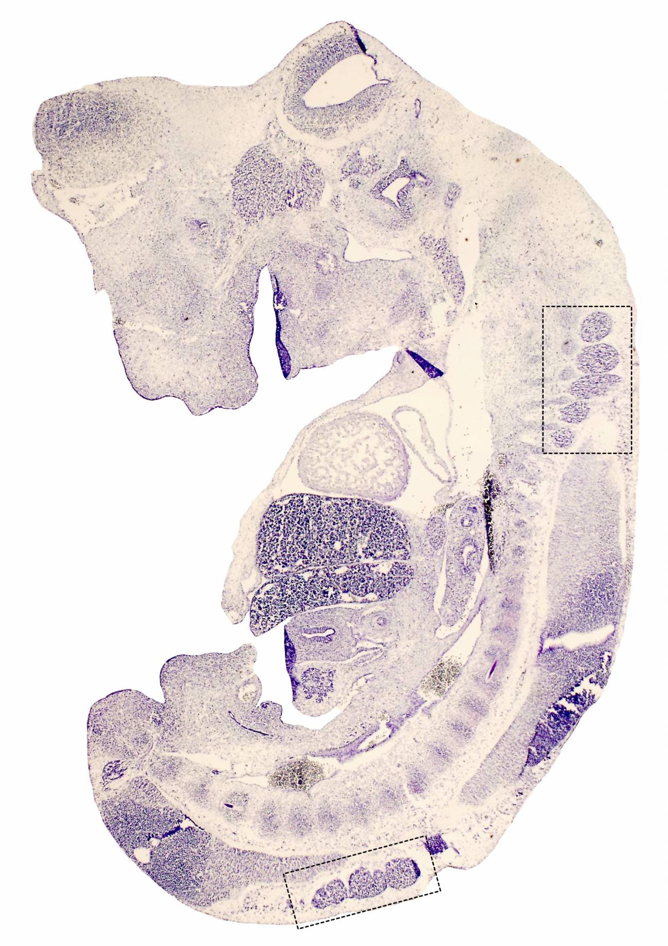 Existen dos tipos de receptores de neurotrofinas, p75 y los de la familia Trk