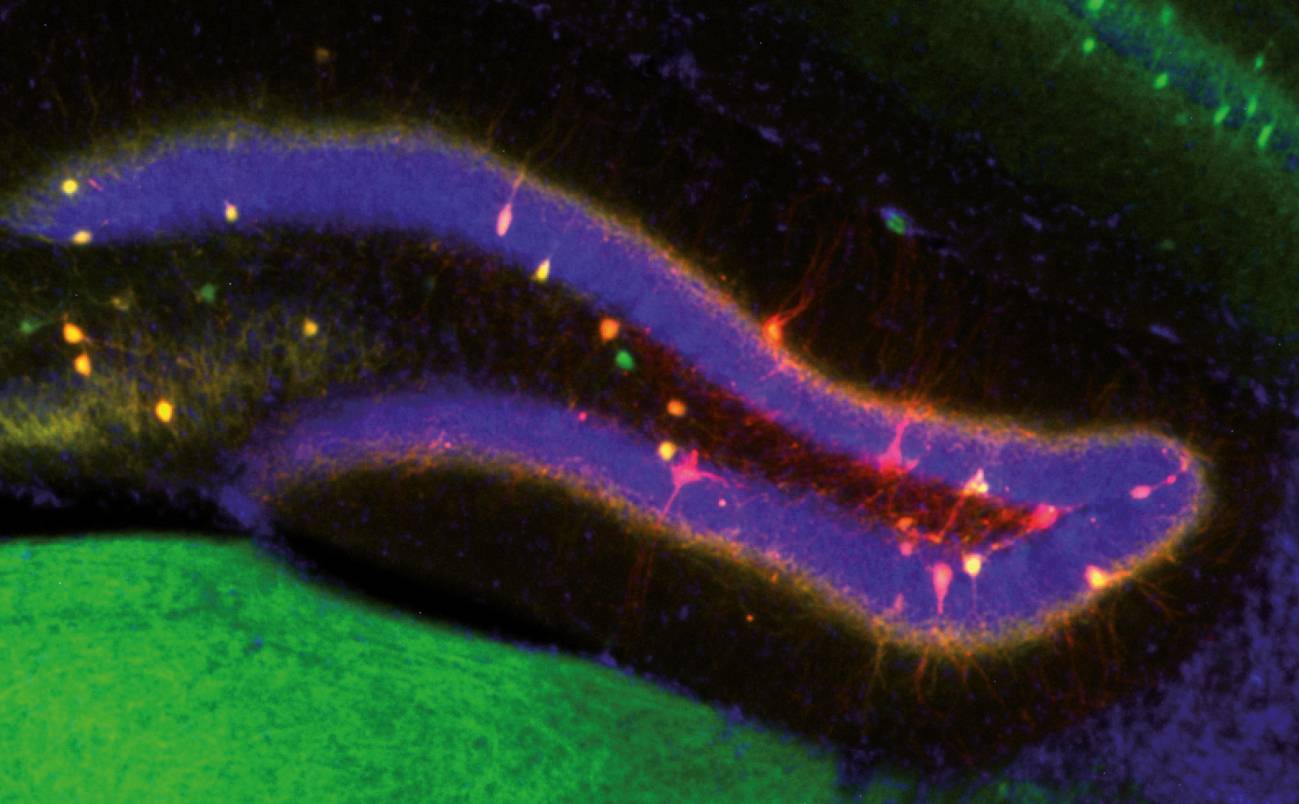 Hallan cómo el cerebro encuentra un equilibrio entre actualizar la memoria con nuevos datos y conservar los recuerdos