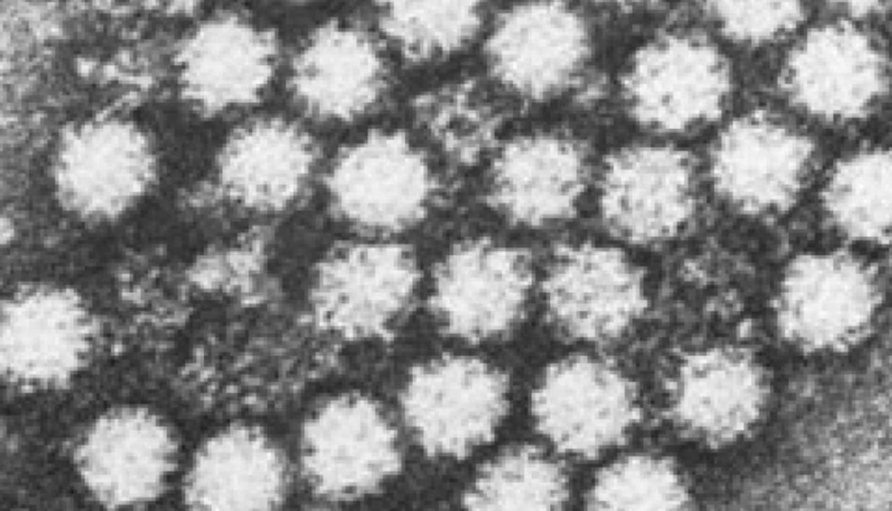 Hallan el origen de dos brotes de norovirus de un hospital madrileño en 2024