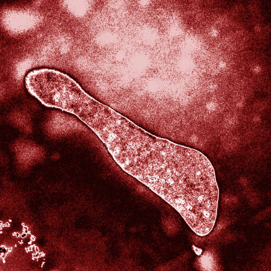Hallan en un microorganismo primitivo una proteína capaz de reparar ADN