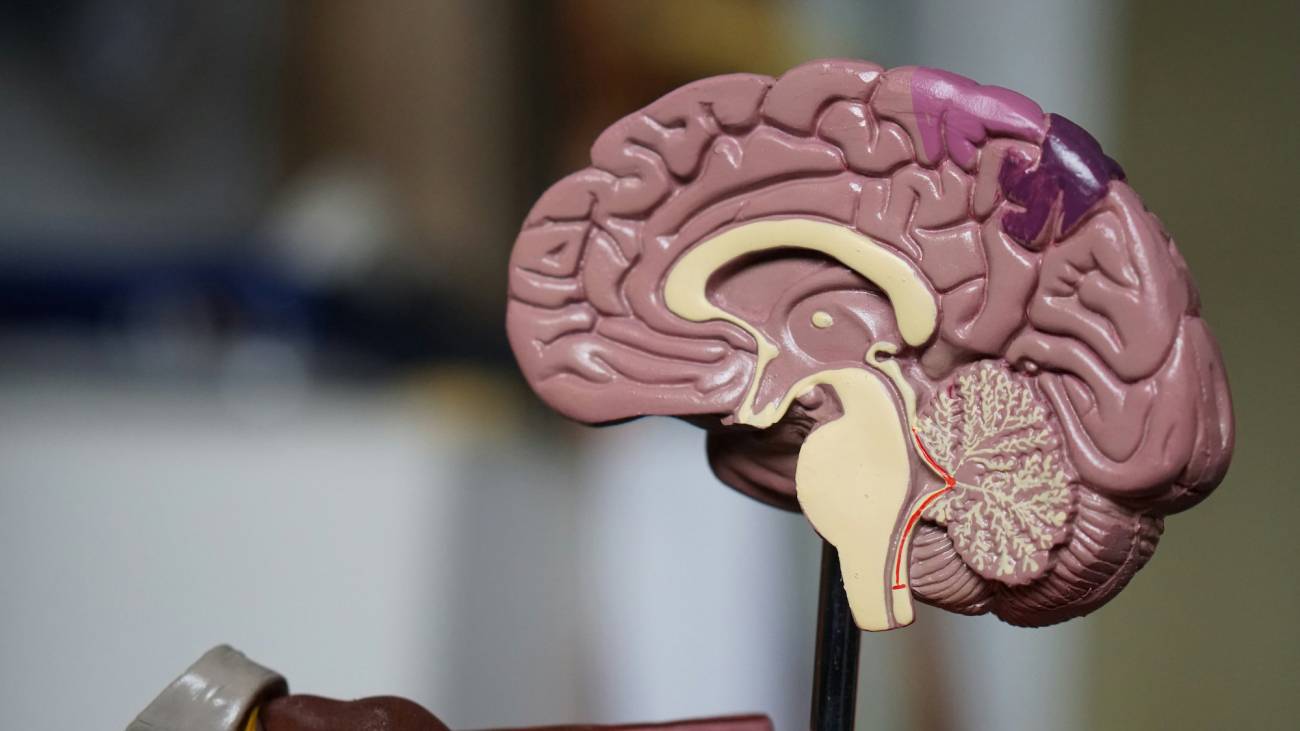 Hallan un incremento de una proteína en el cerebro y el líquido cefalorraquídeo de personas con alzhéimer