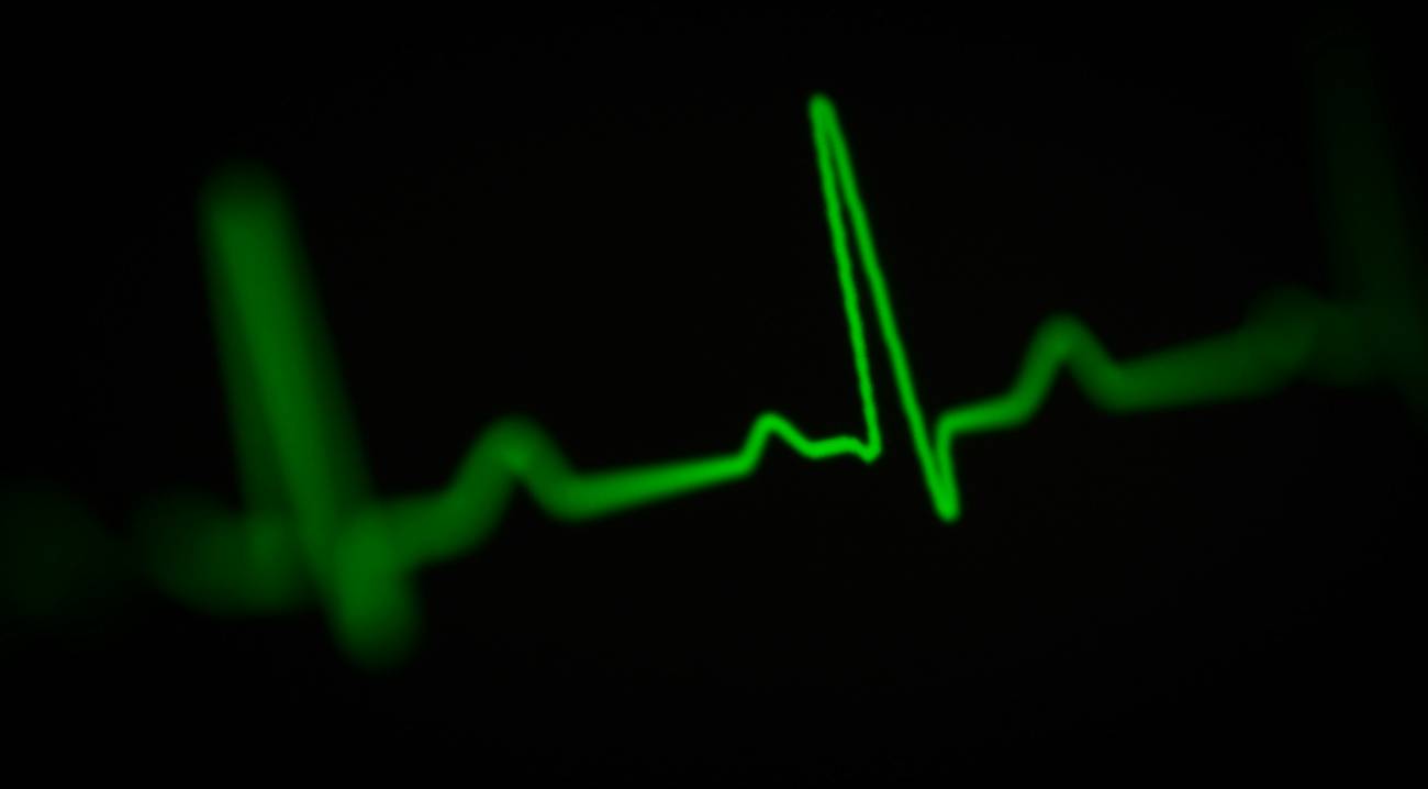 Electrocardiograma en verde