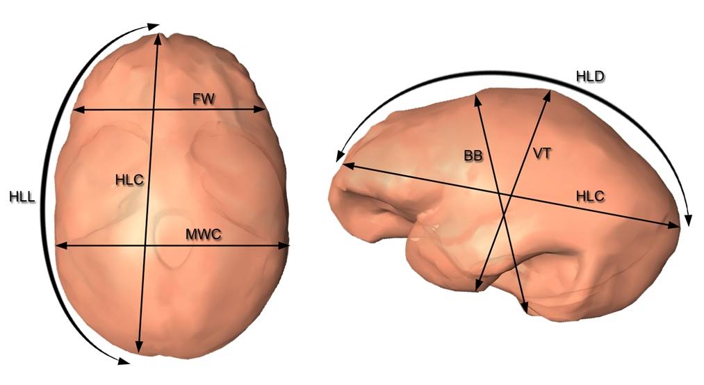 ‘Homo erectus’ africanos y asiáticos compartieron la misma forma cerebral