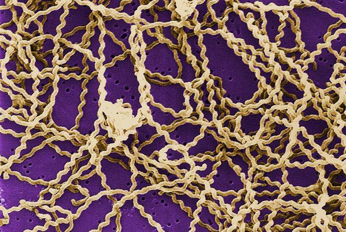 Bacteria del género Leptospira. / Wikipedia