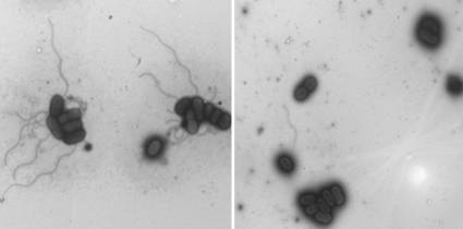 Identificado un actor clave en las infecciones de ‘E. coli’ 
