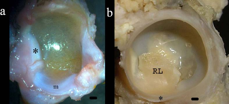 Identifican un menisco en la cadera de los anfibios