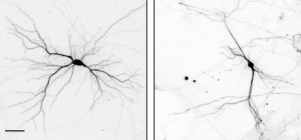 Identifican un nuevo regulador de la formación de neuronas