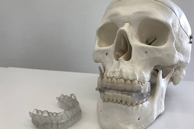 Impresión 3D personalizada para prevenir la apnea del sueño