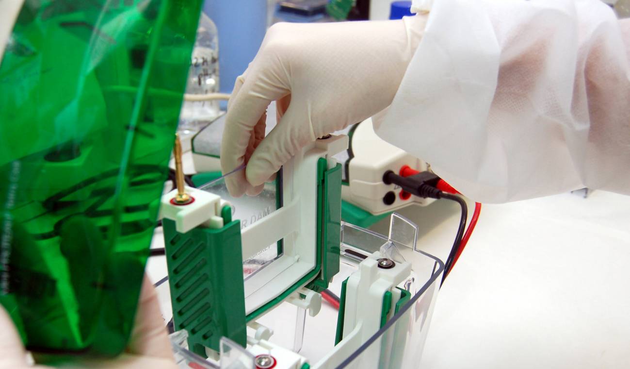 Investigadores concluyen que las enfermedades mentales se clasifican dentro de las neurodegenerativas