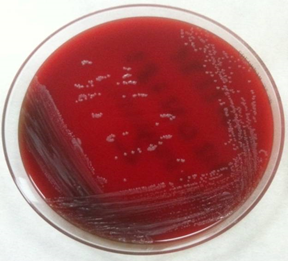 Investigan la resistencia a antibióticos de la bacteria ‘Dermabacter hominis’
