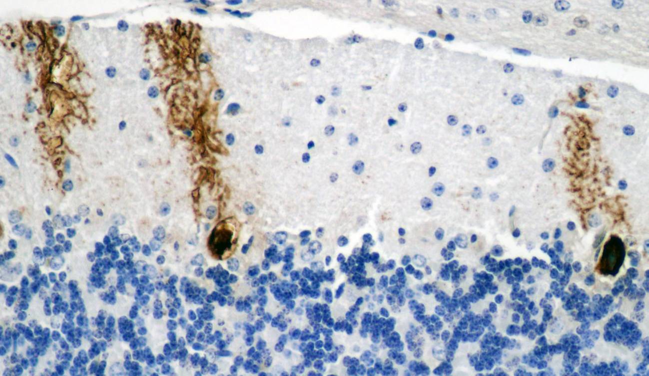 La acumulación de glucógeno en las neuronas acorta la vida en moscas y ratones