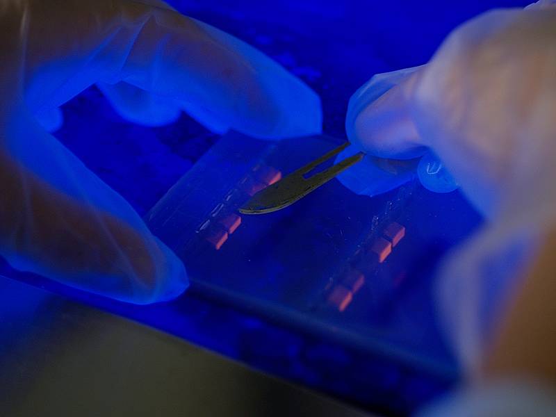 La bioestadística genera nuevos predictores genéticos de enfermedades