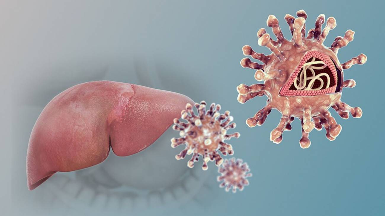 La crisis de enfermedad hepática crónica en Europa: prevenible, pero pasa desapercibida