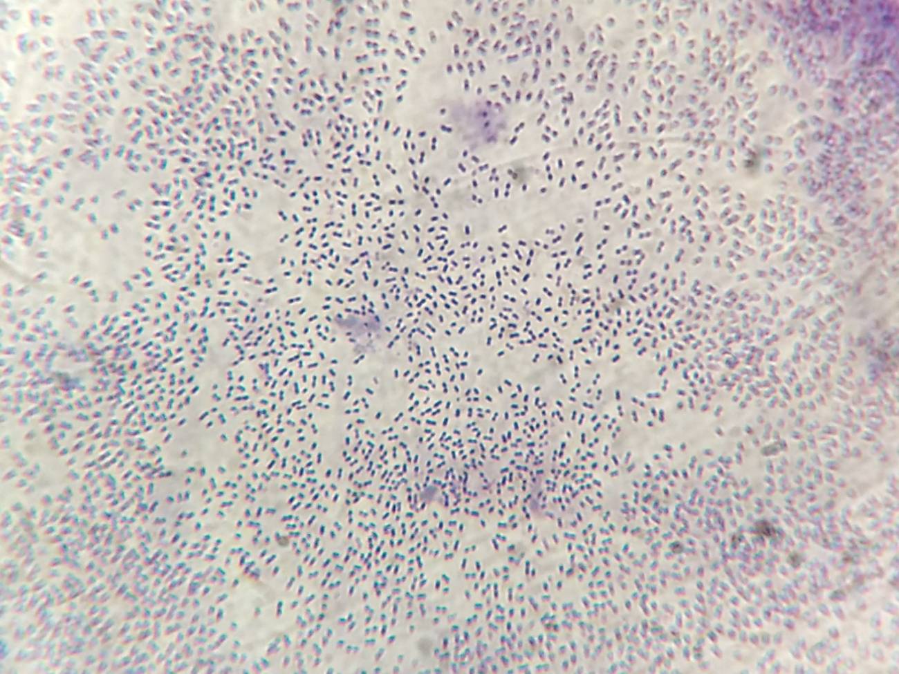 Streptococcus pneumoniae