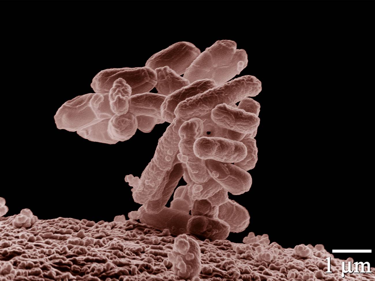 bacteria E. Coli