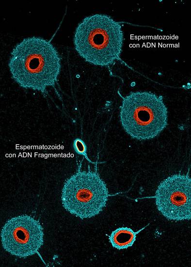 La eyaculación recurrente mejora los espermatozoides