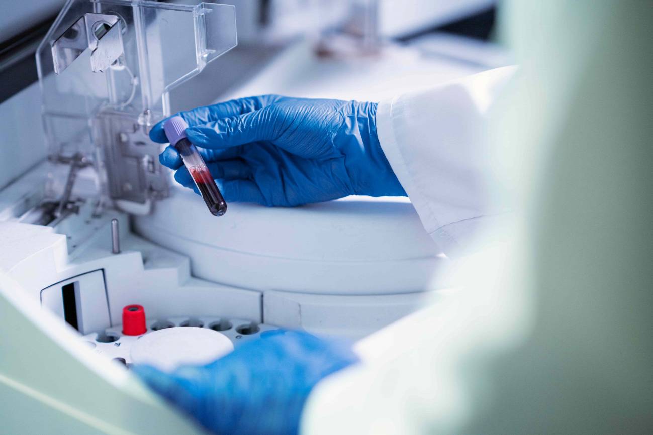 La gepotidacina: nuevo fármaco seguro y eficaz para la gonorrea