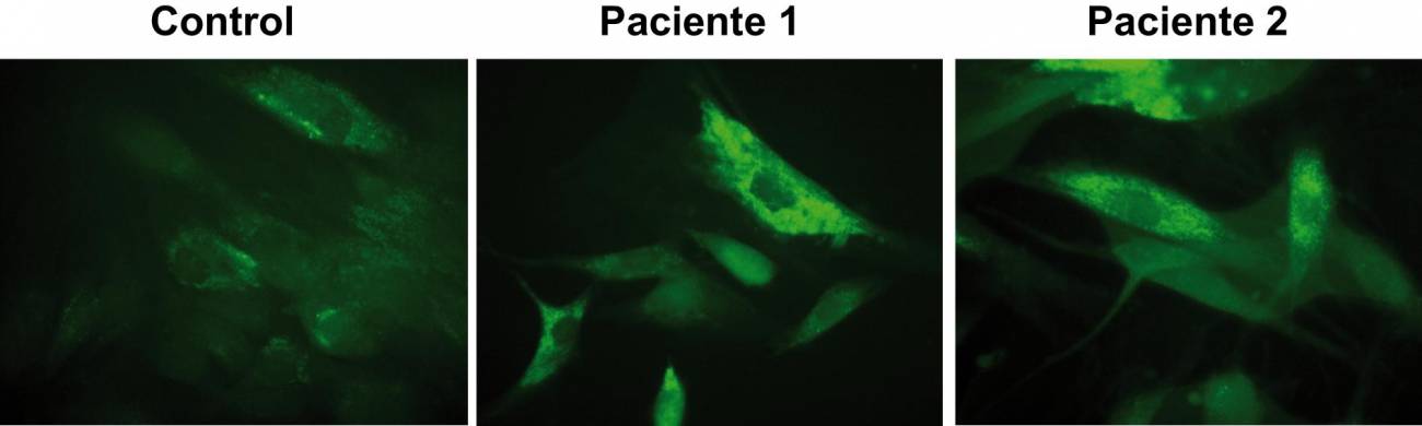 La importancia del diagnóstico y de la investigación en nuevas terapias para las enfermedades raras