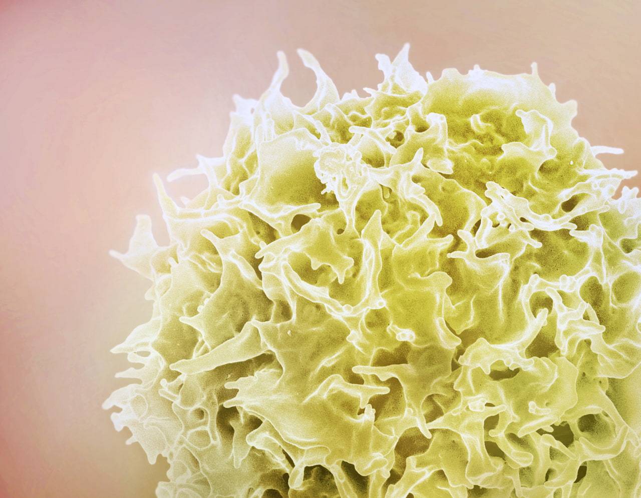 La obesidad deja una huella en las células inmunitarias incluso diez años después de perder peso