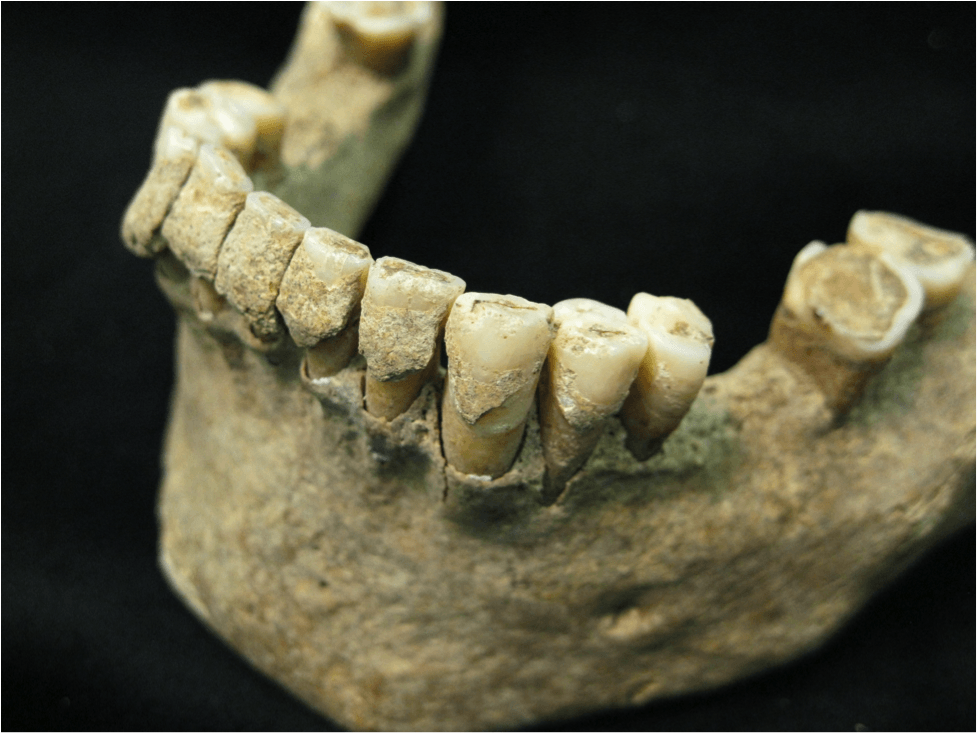 La placa dental conserva el microbioma oral milenario
