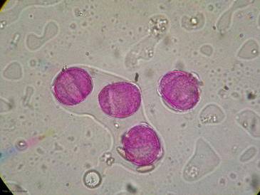  Polen de plátano de sombra al microscopio.