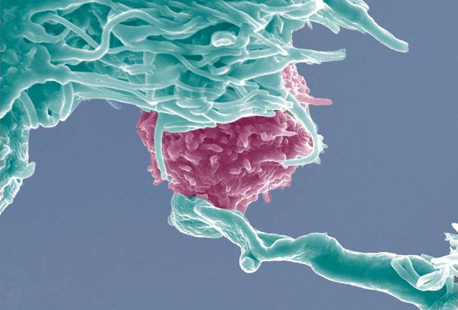 Histología de muestras de colon de ratones en condiciones basales o varios días después de ser tratados con el agente inductor de colitis DSS (inflamatorio). Las preparaciones corresponden a ratones normales (WT) o ratones mutantes que carecían de NFAT5 en linfocitos T (KO). Imagen cedida por los autores (DCEXS-UPF)