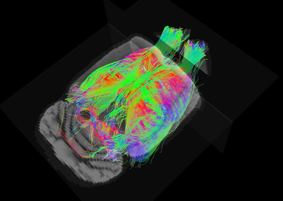 Fibras cerebrales del cerebro de una rata