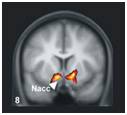 Núcleo accumbens