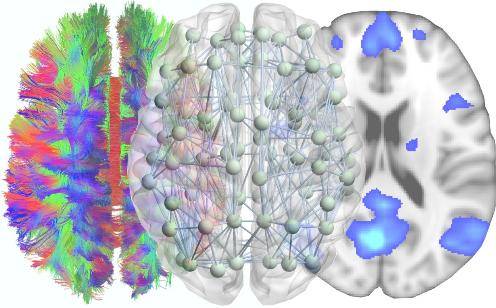 La teoría de redes complejas ayuda a entender cómo funciona el cerebro