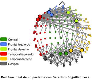 La Teoría de Redes Complejas da nuevas pistas sobre las enfermedades cerebrales