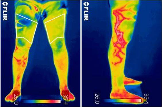 Imagen termográfica