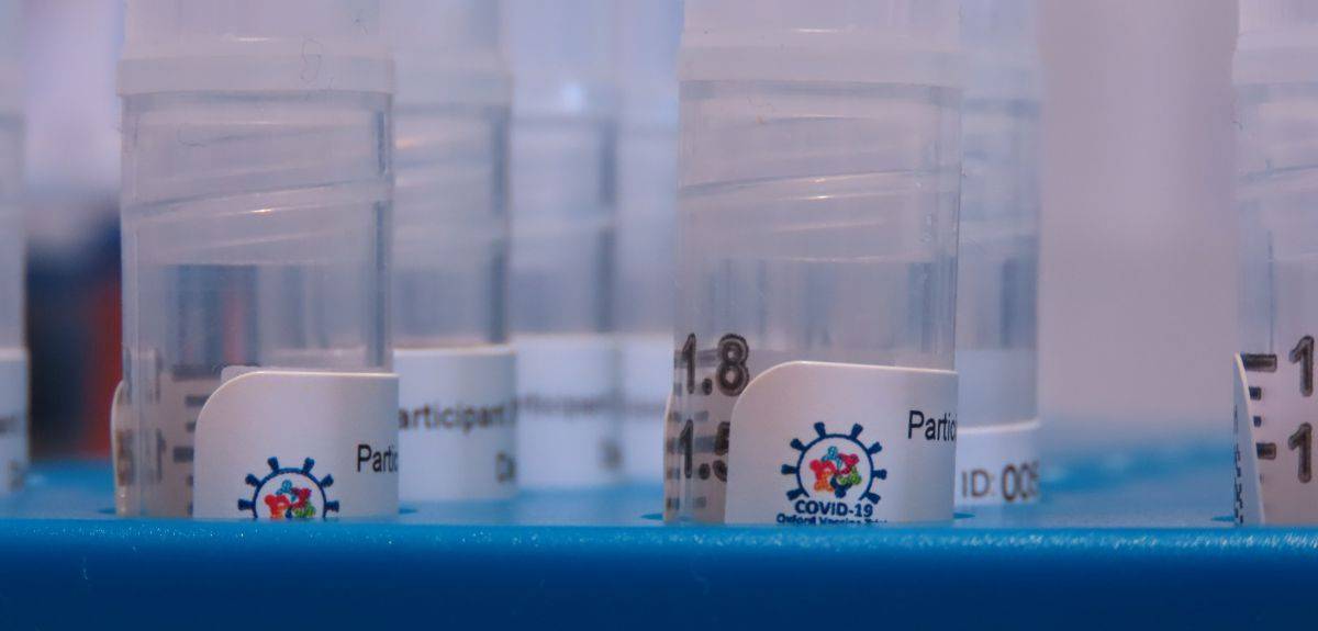 La Universidad de Oxford probará su vacuna contra la COVID-19 en más de 10.000 voluntarios