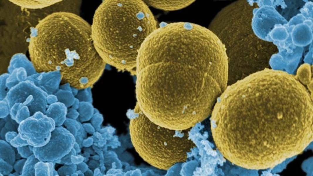 Las bacterias más ‘pegajosas’ pueden causar infecciones menos severas