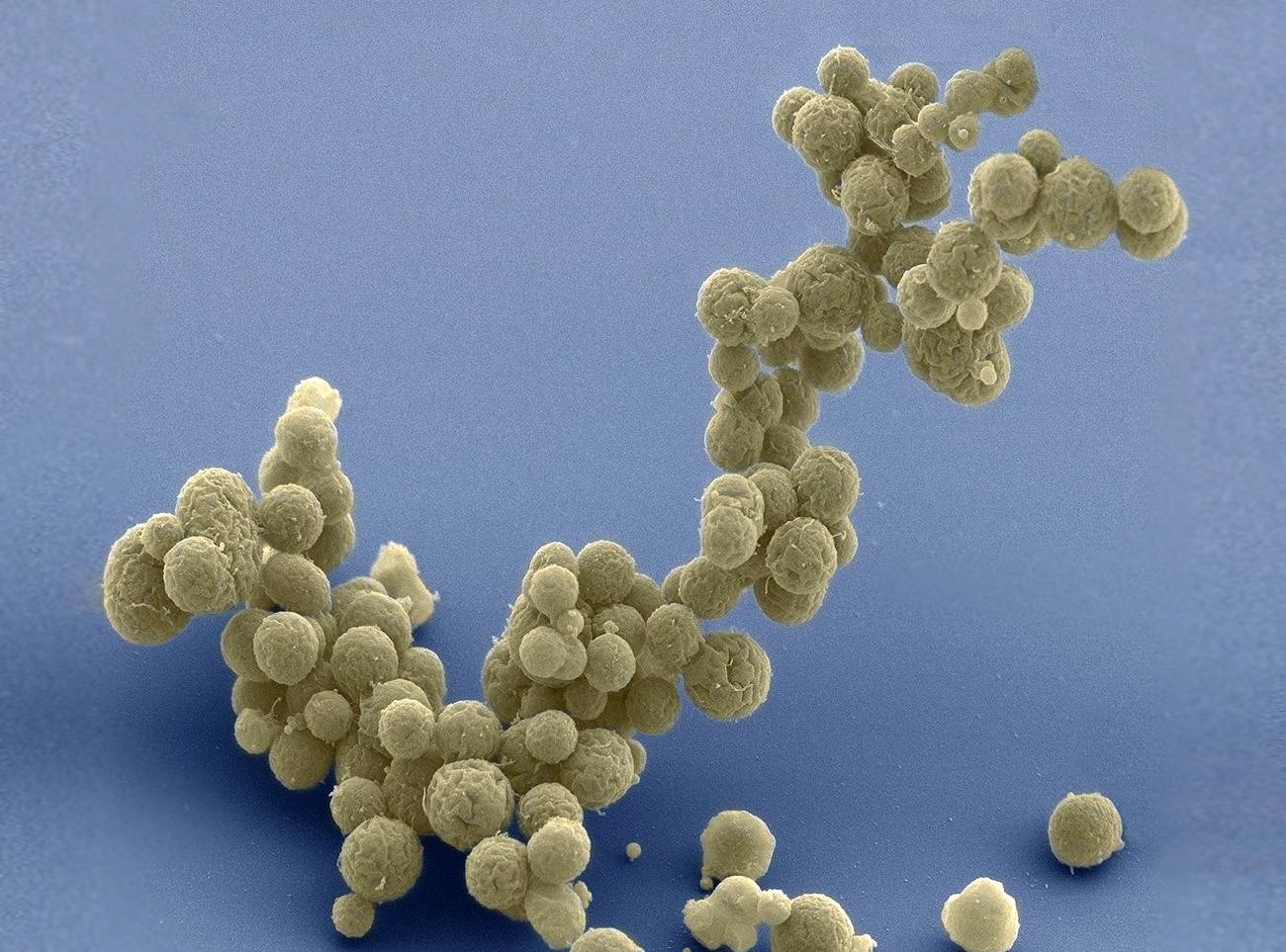 Mycoplasma mycoides simplificada de forma sintética