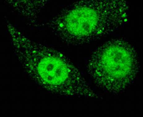 MicroRNA