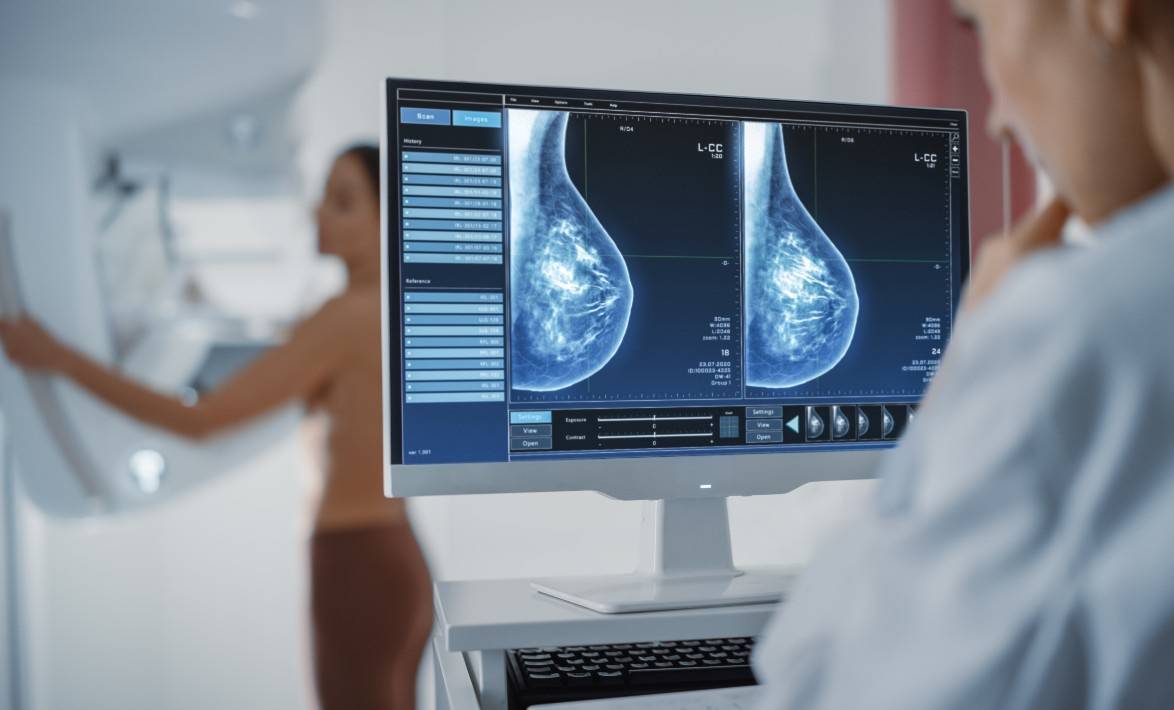 Las dietas grasientas favorecen la metástasis del cáncer de mama en ratonas 